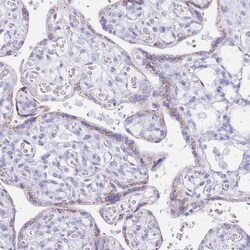 FAM3C Antibody, Novus Biologicals:Antibodies:Primary Antibodies