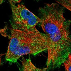 FAM47E Antibody, Novus Biologicals 25 &mu;L | Buy Online | Novus Biologicals | Fisher Scientific