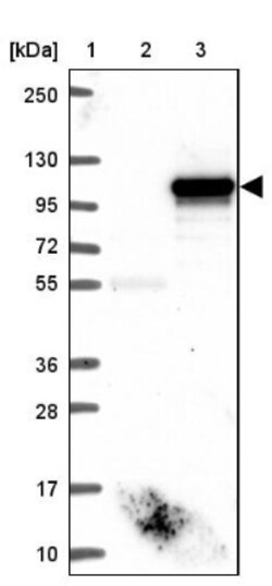 FAM48A Antibody, Novus Biologicals 0.1mL; Unlabeled:Antibodies, Polyclonal