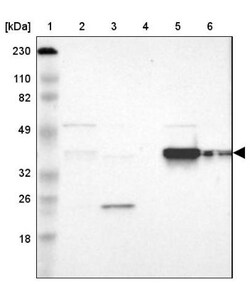FAM50A Antibody, Novus Biologicals 0.1mL; Unlabeled:Antibodies, Polyclonal