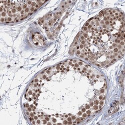 FAM53A Antibody, Novus Biologicals 0.1mL; Unlabeled:Antibodies, Polyclonal
