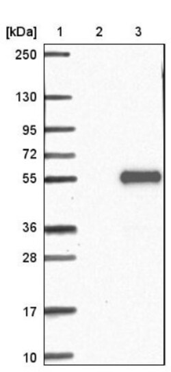 FAM53A Antibody, Novus Biologicals 0.1mL; Unlabeled:Antibodies, Polyclonal