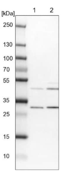 FAM53B Antibody, Novus Biologicals 25 &mu;L; Unlabeled:Antibodies, Polyclonal