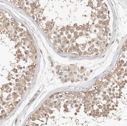 FAM54A Antibody, Novus Biologicals 0.1mL; Unlabeled:Antibodies, Polyclonal