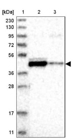 FAM54A Antibody, Novus Biologicals 0.1mL; Unlabeled:Antibodies, Polyclonal