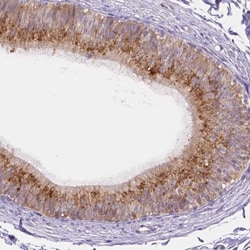 FAM55B Antibody, Novus Biologicals 25 &mu;L, Unlabeled:Antibodies, Polyclonal