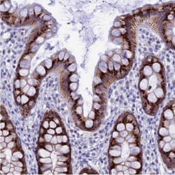 FAM55D Antibody, Novus Biologicals 0.1mL; Unlabeled:Antibodies, Polyclonal
