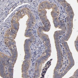 FAM62B Antibody, Novus Biologicals 25 &mu;L; Unlabeled:Antibodies, Polyclonal