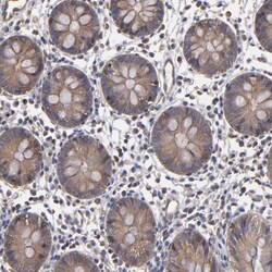 FAM62B Antibody, Novus Biologicals 25 &mu;L; Unlabeled:Antibodies, Polyclonal