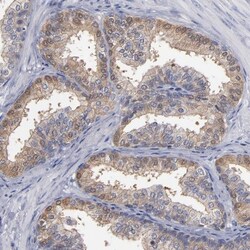 FAM62B Antibody, Novus Biologicals 25 &mu;L; Unlabeled:Antibodies, Polyclonal