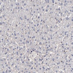 FAM62B Antibody, Novus Biologicals 25 &mu;L; Unlabeled:Antibodies, Polyclonal