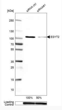 FAM62B Antibody, Novus Biologicals 25 &mu;L; Unlabeled:Antibodies, Polyclonal