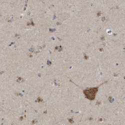 FAM69A Antibody, Novus Biologicals 25 &mu;L, Unlabeled:Antibodies, Polyclonal