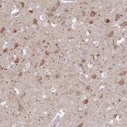 FAM69C Antibody, Novus Biologicals 25 &mu;L, Unlabeled:Antibodies, Polyclonal