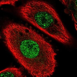 FAM70B Antibody, Novus Biologicals 0.1mL; Unlabeled:Antibodies, Polyclonal