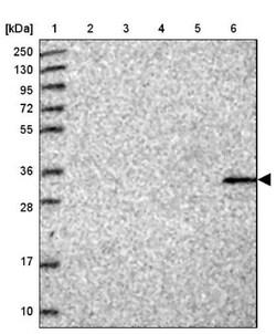 FAM70B Antibody, Novus Biologicals 0.1mL; Unlabeled:Antibodies, Polyclonal