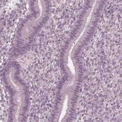 FAM71A Antibody, Novus Biologicals 25 &mu;L | Buy Online | Novus Biologicals | Fisher Scientific