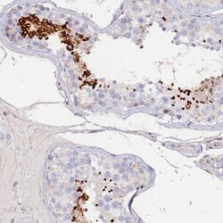 FAM71B Antibody, Novus Biologicals 25 &mu;L; Unlabeled:Antibodies, Polyclonal