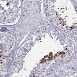 FAM71B Antibody, Novus Biologicals 25 &mu;L; Unlabeled:Antibodies, Polyclonal