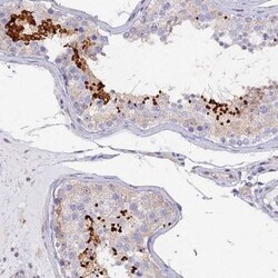 FAM71B Antibody, Novus Biologicals 25 &mu;L; Unlabeled:Antibodies, Polyclonal