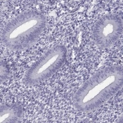 FAM71B Antibody, Novus Biologicals 25 &mu;L; Unlabeled:Antibodies, Polyclonal