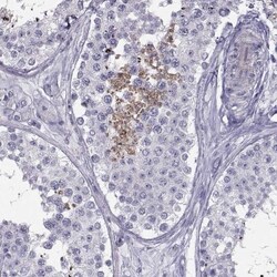 FAM71B Antibody, Novus Biologicals 25 &mu;L; Unlabeled:Antibodies, Polyclonal