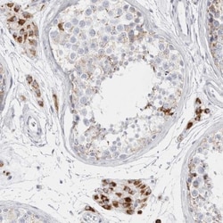 FAM71F2 Antibody, Novus Biologicals 0.1mL; Unlabeled:Antibodies, Polyclonal