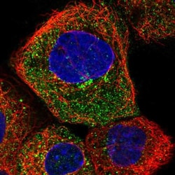FAM72A Antibody, Novus Biologicals 25 &mu;L; Unlabeled:Antibodies, Polyclonal