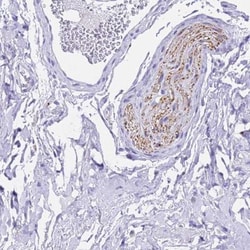 FAM72A Antibody, Novus Biologicals 25 &mu;L; Unlabeled:Antibodies, Polyclonal
