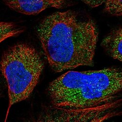 anti-FAM73B, Polyclonal, Novus Biologicals 0.1mL; Unlabeled:Antibodies,