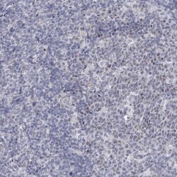 FAM76B Antibody, Novus Biologicals:Antibodies:Primary Antibodies