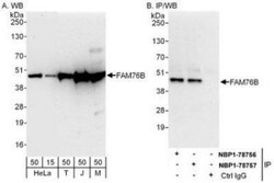 FAM76B Antibody, Novus Biologicals 0.1mg; Unlabeled:Antibodies, Polyclonal