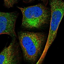 FAM82A Antibody, Novus Biologicals:Antibodies:Primary Antibodies