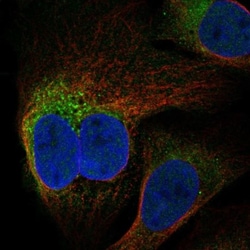 FAM82A Antibody, Novus Biologicals:Antibodies:Primary Antibodies