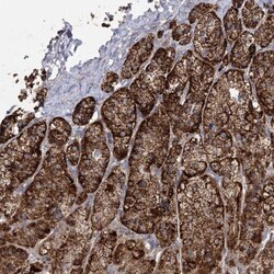 FAM82A Antibody, Novus Biologicals:Antibodies:Primary Antibodies