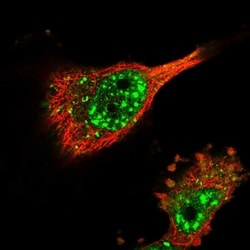 FAM83B Antibody, Novus Biologicals 25 &mu;L; Unlabeled:Antibodies, Polyclonal
