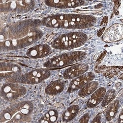 FAM83B Antibody, Novus Biologicals 25 &mu;L; Unlabeled:Antibodies, Polyclonal