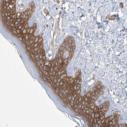 FAM83B Antibody, Novus Biologicals 25 &mu;L; Unlabeled:Antibodies, Polyclonal