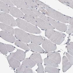 FAM83G Antibody, Novus Biologicals 25 &mu;L, Unlabeled:Antibodies, Polyclonal