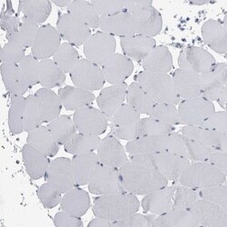 FAM83H Antibody, Novus Biologicals 0.1mL; Unlabeled:Antibodies, Polyclonal