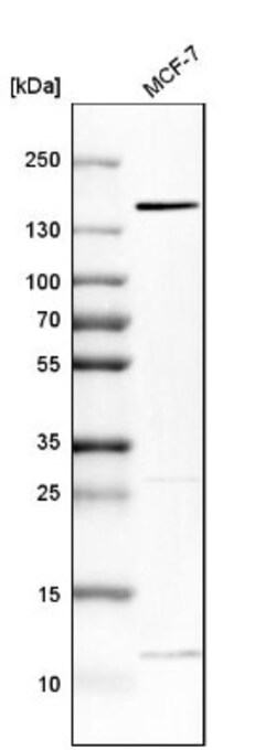 FAM83H Antibody, Novus Biologicals 0.1mL; Unlabeled:Antibodies, Polyclonal