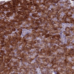 FAM84A Antibody, Novus Biologicals 0.1mL; Unlabeled:Antibodies, Polyclonal