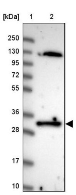 FAM84A Antibody, Novus Biologicals 0.1mL; Unlabeled:Antibodies, Polyclonal