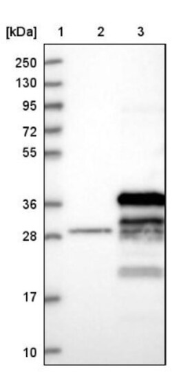 FAM92B Antibody, Novus Biologicals 0.1mL; Unlabeled:Antibodies, Polyclonal