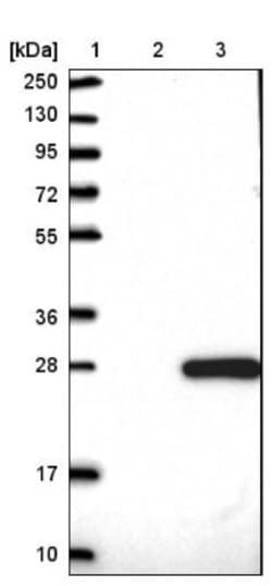 FAM96A Antibody, Novus Biologicals 25 &mu;L | Buy Online | Novus Biologicals | Fisher Scientific