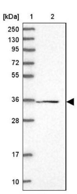 FAM98C Antibody, Novus Biologicals 25 &mu;L | Buy Online | Novus Biologicals | Fisher Scientific