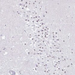 FAM9A Antibody, Novus Biologicals 0.1mL; Unlabeled:Antibodies, Polyclonal