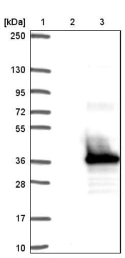 FAM9B Antibody, Novus Biologicals:Antibodies:Primary Antibodies