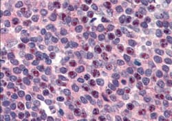 FANCG Antibody, Novus Biologicals 0.1mg; Unlabeled:Antibodies, Polyclonal