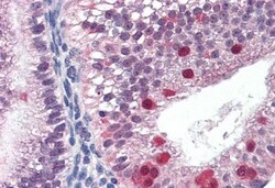 FANCG Antibody, Novus Biologicals 0.1mg; Unlabeled:Antibodies, Polyclonal